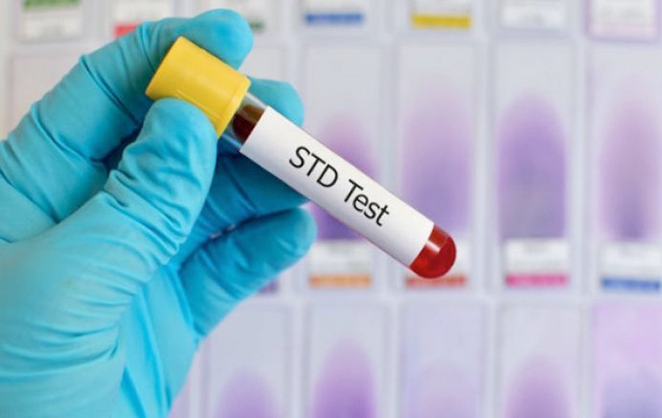 Thumbnail for Home Std Testing – Purchase Home Std Test Online