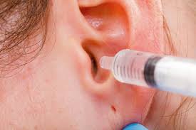 Thumbnail for Expert Microsuction Ear Wax Removal Services Available in London